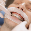 Orthodontie - Centre Dentaire Rabat - Centre Dentaire Zaoui - Dentiste Rabat-min