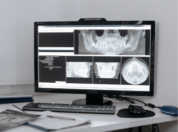 Radiographie Numérique Dentaire - Centre Dentaire Zaoui Rabat - Centre Dentaire Rabat - Dentiste Rabat